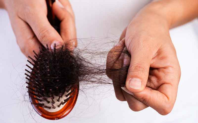 After black fungus infection, post-covid patients experiencing hair loss