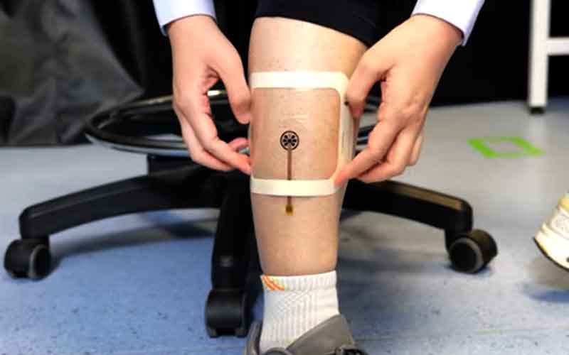 Scientists invented wireless and battery-free wound infection sensor based on DNA hydrogel