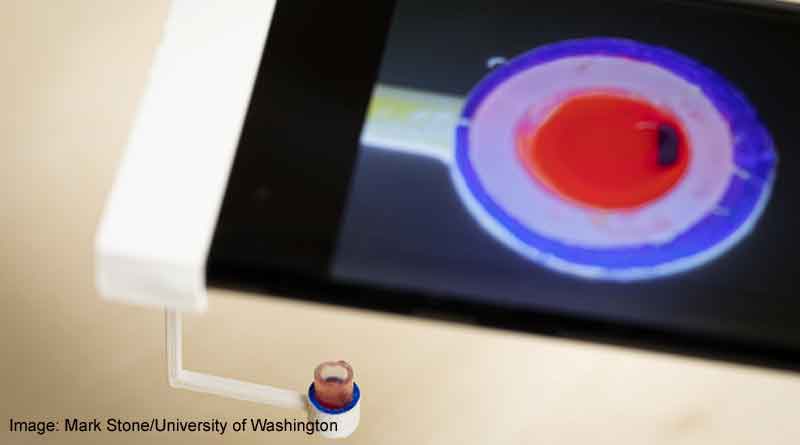 Smartphone app can vibrate a single drop of blood to determine how well it clots