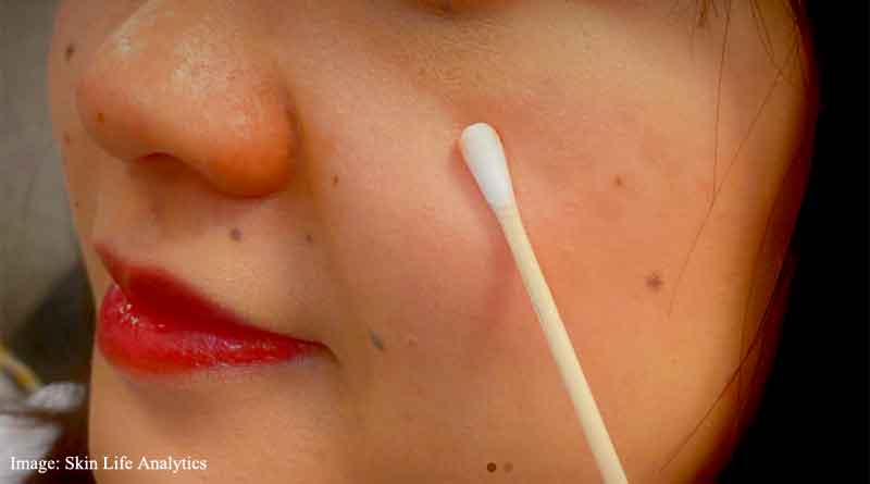 Scientists develop swab test to identify premature skin ageing