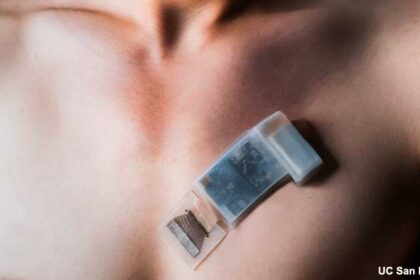 New wearable ultrasound system