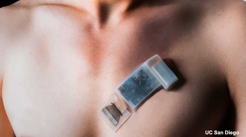 New wearable ultrasound system